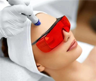 نظارات سلامة الليزر لليزر النبضي 532nm