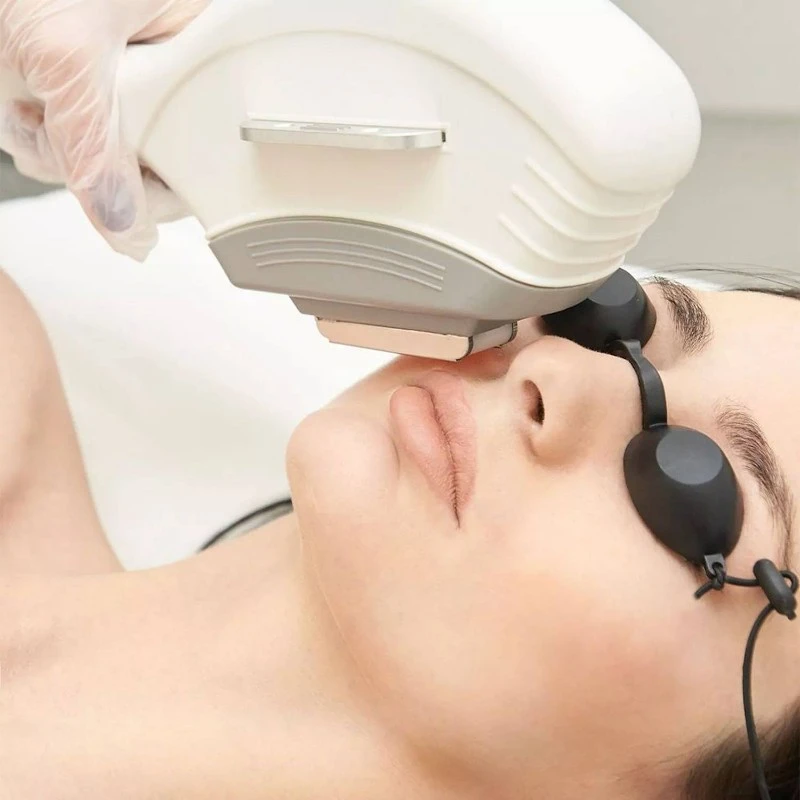 laser beauty laser beauty